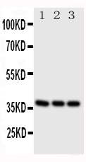 WB - Anti-CD1a Antibody ABO11182